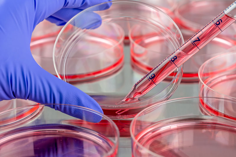 Custom cell lines development - InvivoGen Custom cell lines development - InvivoGen