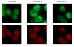 Detection of fluorescent puncta from rapamycin-mediated autophagy