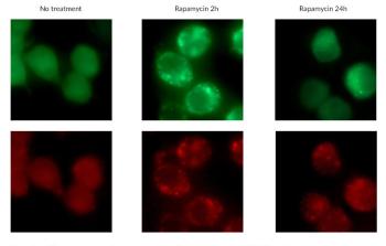 Detection of fluorescent puncta from rapamycin-mediated autophagy Detection of fluorescent puncta from rapamycin-mediated autophagy