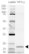 Detection by SDS-PAGE Detection by SDS-PAGE