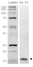 Detection of human IL-21 by SDS-PAGE