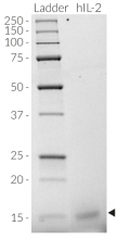 Detection of IL-2 by SDS-PAGE