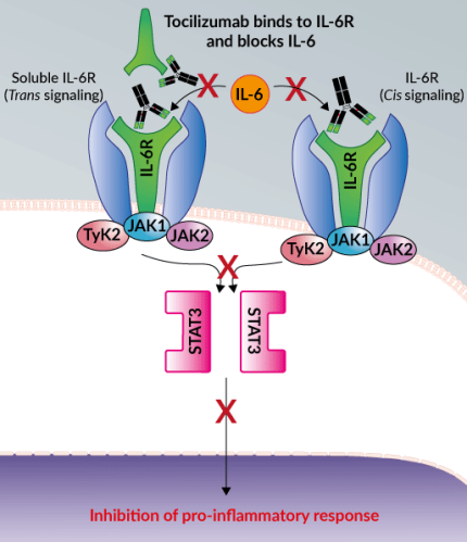 Tocilizumab blocks IL-6