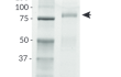Nucleocaspid-Fc purity analysis by SDS-PAGE Nucleocaspid-Fc purity analysis by SDS-PAGE