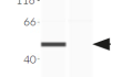 Validation of IRF3 knockout by Western blot (Wes™) Validation of IRF3 knockout by Western blot (Wes™)