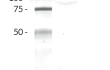 Spike-S1-Fc (D614G) purity analysis by SDS PAGE